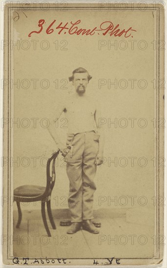 G.T. Abbott 4. Vt. Civil War victim; American; 1864 - 1870; Albumen silver print