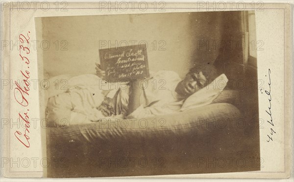 Edward Scott, Civil War victim; American; 1862-1870; Albumen silver print