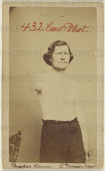 Charles Dunn 5th Mich. Cav. Civil War victim lacking an arm; American; 1864 - 1866; Albumen silver print