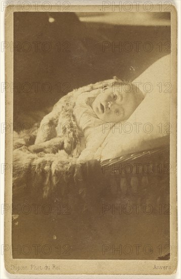 Paul 10 moins baby in a crib looking up out; J. Dupont, Belgian, 1818 - 1901, about 1870; Albumen silver print