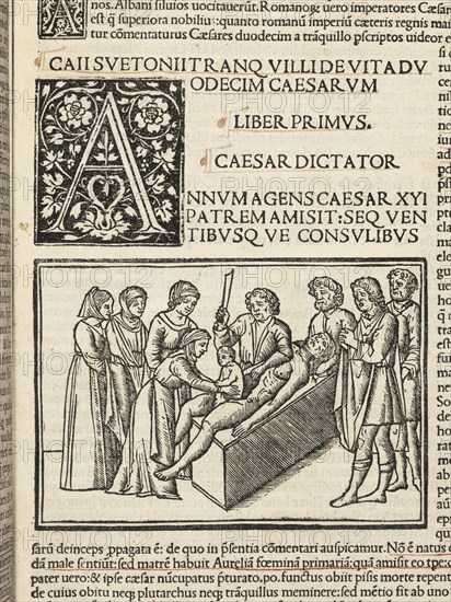 Detail of leaf, 5, recto with illustration depicting Julius Caesar's birth by caesarian section, Suetonius Tranquillus cum