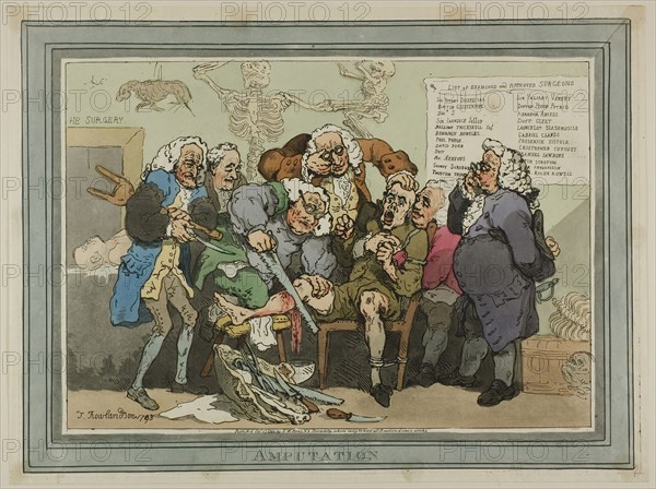 Amputation, published October 17, 1793, Thomas Rowlandson (English, 1756-1827), Published by S.W. Fores (English, 1761-1838), England, Hand-colored etching on ivory wove paper, 300 × 400 mm (image), 317 × 420 mm (sheet)