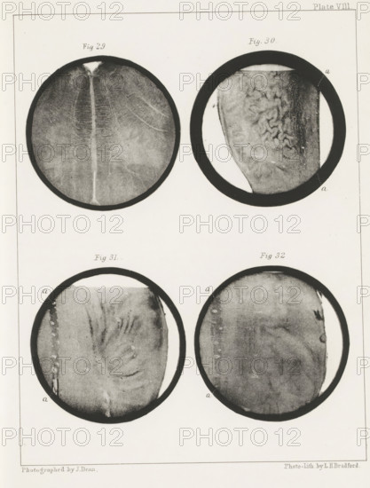 Four longitudinal and transverse sections of a human medulla oblongata, page, photomechanical print, number: 'Plate VIII. Fig. 29. Fig 30. Fig. 31. Fig. 32.', photographer: John Dean, printmaker: Bradford & Co, LH, c. 1854 - in or before 1864, paper, photolithography, height 301 mm x width 230 mm, brains, Four circular photographic images are arranged in a grid with two across and two down, each framed by a dark ring against a pale background. The top left circle shows a grainy, textured surface with a central vertical lighter band and subtle radiating lines. The top right circle contains a textured surface with irregular ridges and folds on one side and a vertical darker band along the rim. The bottom left circle displays a softer, mottled texture with curved striations and a lighter vertical streak near one edge. The bottom right circle features a diffuse, cloudy surface with uneven shading and a few darker spots near the perimeter. The surrounding page shows a thin rectangular borde...
