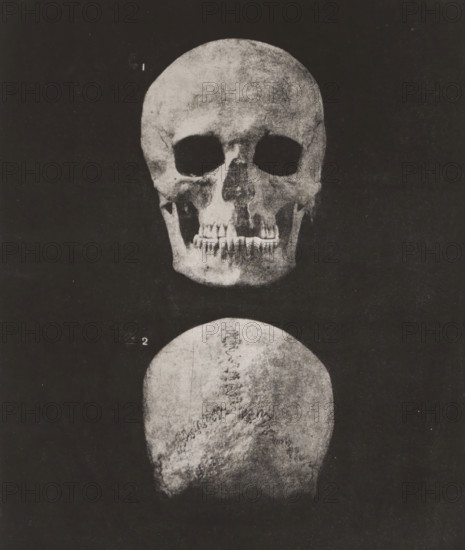 Two views of a human skull, front view and back view, 1. TÊTE HUMAINE FACE, 2. IDEM OCCIPUT VOIR PL. 33. 1, 2 nature, page, photomechanical print, inscription: 'Ville de Paris. Atelier des Travaux historiques E. Lacan, dir. Procédé special photo-lithographique.', number: 'Pl. 34', monogram: 'LEL', France, cliché maker: Ville de Paris Atelier des Travaux historiques, Paris, publisher: Imprimerie Impériale, supervision: Ernest Lacan, c. 1860 - in or before 1869, photographer, paper, photolithography, height 237 mm x width 188 mm, For location of print in book: see number under 'Inscriptions, Brands'., animals (skeleton of an animal), palaeontology, A vertically oriented black and white image shows two human skull views against a dark background, the upper view facing forward and the lower view showing the top of the skull. The forward-facing skull displays eye sockets, nasal cavity, and a visible set of upper and lower teeth, with varied surface texture and shading. The top-view skull sh...