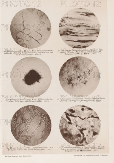 Six microscope images of bacteria, page, photomechanical print, number: 'Tafel X.', inscription: '55. Recurrence spirals. Mensch. Broke. Deckgalsausstrichpräparat. With 5% cleaning and cleaning done. 1000:1. 56. Bacilli in Zahnbeinkanälchen. Mensch. Zahncaries. Schnitt. Nach Gram-Günther gefärbt. Präparat von WD Miller. 500:1. 57. Actinomyces bovis. Druse. Rind. Kiefergeschwulst. Schnitt. Farbung nach Gram-Günther. 500:1. 58. Actinomyces bovis. Faden. Rind. Kiefergeschwulst. Schnitt. Farbung nach Gram-Günther. 500:1. 59. Herpes tonsurans-Pilz. Agarplattencultur. With deck glass covered and direct photography. 240:1. 60. Plasmodium malariae in Segmentation. Mensch. Febris perniciosa. Gehirnschnitt. Bismarckbraun. Präparat von E. Marchiafava. 500:1.', photographer: Carl Günther, Berlin, maker: Friedrich Julius Klinkhardt, Leipzig, c. 1880 - in or before 1890, Saxony, paper, collotype, photoprint, height 242 mm x width 165 mm, Prints in section at the back., unicellular animals, bacteria,...
