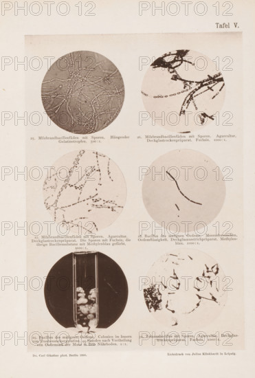 Six microscope images of bacteria, including the anthrax bacterium, page, photomechanical print, number: 'Tafel V.', inscription: '25. Milzbrandbacteriadenfaeden mit Sporen. Hängender Gelatintropfen. 500:1. 26. Milzbrandbacillienfäden mit Sporen. Agar culture. Deckglassrockenpräparat. Fuchsin. 1000:1. 27. Milzbrandbacillienfäden mit Sporen. Agar culture. Deckglassrockenpräparat. Die Sporen mit Fuchsin, die übrige Bacillensubstanz mit Methylenblau gefärbt. 1000:1. 28. Bacillus des maligen Edemas. Meerschweiden. Edema fluidity. Deckglasausstrichpräparat. Methylenblau. 1000:1. 29. Bacilli de malignant Edema. Colonien im Innern von Traubenzuckergelatine, 44 Stunden nach Vertheilung von Oedemsaft der Maus in dem Nährboden. 1:1. 30. Tetanus bacillus with spores. Agar culture. Deckglassrockenpräparat. Fuchsin. 1000:1..', photographer: Carl Günther, Berlin, maker: Friedrich Julius Klinkhardt, Leipzig, c. 1880 - in or before 1890, Saxony, paper, collotype, photoprint, height 242 mm x width 165 ...