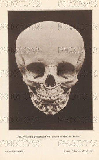 Children's skull with alternating teeth, page, photomechanical print, number: 'Tafel VII.', cliché maker: Gemoser & Waltl, Cologne, c. 1867 - in or before 1877, Gemoser & Waltl, photographer, cliché maker, North Rhine-Westphalia, paper, collotype, photoprint, height 145 mm x width 101 mm, (human) skull, teeth, A photograph shows a human skull facing forward against a dark rectangular background framed by a lighter border; the skull has a smooth rounded forehead with visible sutures, deep eye sockets, a nasal cavity, and an upper and lower jaw with visible teeth and dental structures, with the overall image centered on the skull and surrounded by a pale margin.