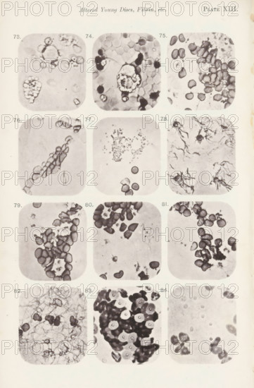 Twelve enlargements of blood corpuscles, page, photomechanical print, number: 'Pl. XIII.', number: 'Photo. 73., Photo. 84.', photographer: Richard Norris, cliché maker: anonymous, c. 1872 - in or before 1882, paper, collotype, photoprint, height 213 mm x width 135 mm, Page opposite page 213., blood, A vertically oriented page shows a grid of rounded-corner square photographic panels arranged in rows and columns, each panel containing close-up grayscale microscopic images of irregularly shaped cellular structures and fibrous material. The panels display clusters of small oval and circular forms with darker edges and lighter centers, some appearing grouped or overlapping, others dispersed singly; several panels contain branching, threadlike fibrous networks or starburst-like filamentous shapes against lighter backgrounds. The photographic frames exhibit varying contrast and grain, with some areas showing dense aggregations of dark, pebble-like elements and other areas showing sparse isol...