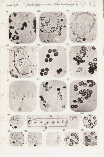 Eleven enlargements of blood corpuscles and fibrin and a diagram, page, photomechanical print, number: 'Photo. 85., Photo. 100.', number: 'Pl. XIV.', photographer: Richard Norris, cliché maker: anonymous, c. 1872 - in or before 1882, paper, collotype, photoprint, height 213 mm x width 135 mm, Page opposite page 215., blood, statistic diagram, graph, pictorial chart, A vertical page showing a grid of rounded-square photographic panels arranged in rows, each panel containing close-up microscopic images of various circular and irregular cell-like shapes and granules on pale backgrounds; the images vary in contrast with some showing dense clusters of dark, rounded discs, others showing lighter textured masses with scattered small particles, and a few showing chains or aggregations of tiny specks; a small horizontal diagram with elongated sketches appears near the lower middle of the page flanked by additional circular close-ups, and the overall page has a light margin with faint edge wear.