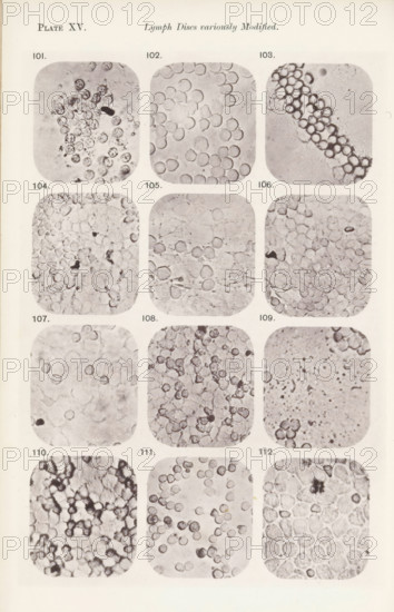 Twelve enlargements of lymphocytes, page, photomechanical print, number: 'Pl. XV.', number: 'Photo. 101., Photo. 112.', photographer: Richard Norris, cliché maker: anonymous, c. 1872 - in or before 1882, paper, collotype, photoprint, height 213 mm x width 135 mm, Page opposite page 217., blood, A vertically oriented page showing a grid of rounded-rectangle photographic panels arranged in three columns and multiple rows, each panel containing close-up grayscale microscopic images of numerous circular and irregular cell-like structures with varying textures and densities; the panels display clusters and strands of small round forms, some appearing hollow or with darker centers, others tightly packed or loosely scattered against pale to mottled backgrounds, with occasional darker irregular specks and thin fibrous lines visible in several panels; the overall page has a light border and a narrow margin around the grid.