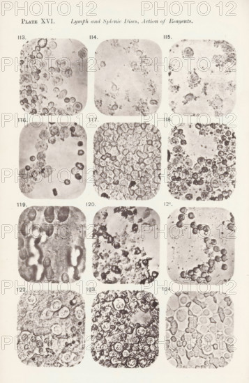 Twelve enlargements of the effects of saline solution on lymphocytes, page, photomechanical print, number: 'Pl. XVI.', number: 'Photo. 113., Photo. 124.', photographer: Richard Norris, clichémaker: anonymous, c. 1872 - in or before 1882, paper, collotype, light print, height 213 mm x width 135 mm, Page opposite page 219., blood, A vertical page with a grid of rounded square photographic panels arranged in columns and rows, each panel showing close-up grayscale images of clustered circular and irregular cellular shapes and textures; the panels vary in density and contrast with some showing dense packed circular units, others showing scattered small specks and faint outlines, and several panels displaying ring-like forms and darker centers; faint numbering appears near each panel but no letters or readable words are described; the page background is pale with a narrow border around the panels.