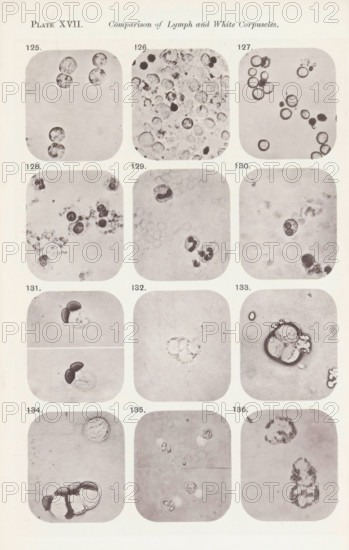 Twelve enlargements of white blood cells, page, photomechanical print, number: 'Pl. XVII.', number: 'Photo. 125., Photo. 136.', photographer: Richard Norris, cliché maker: anonymous, c. 1872 - in or before 1882, paper, collotype, photoprint, height 213 mm x width 135 mm, Page opposite page 221., blood, A vertical sheet showing a grid of rounded square panels arranged in columns, each panel containing circular and irregular dark and light cellular shapes on a pale background; the top has a centered heading area and there are small numeric labels near many panels, while individual panels display clusters of ringed circles, solid dark blobs, and faint granular textures with some panels showing paired darker crescent shapes and others showing dispersed speckled fragments.