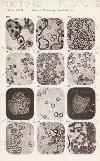 Twelve magnifications of blood corpuscles and myelin, page, photomechanical print, number: 'Pl. XVIII.', number: 'Photo. 137., Photo. 148.', photographer: Richard Norris, cliché maker: anonymous, c. 1872 - in or before 1882, paper, collotype, photoprint, height 213 mm x width 135 mm, Page opposite page 223., blood, A vertical page showing a grid of rounded square photographic panels arranged in columns and rows, each panel containing close-up monochrome images of circular and ring-like shapes that resemble cells or bubbles in various groupings and patterns; some panels show dense clusters, others show scattered rings, some include irregular dark outlines and overlapping circles, and a few panels have darker backgrounds contrasting with the lighter ring structures; the page has margins and small printed numbers near each panel.