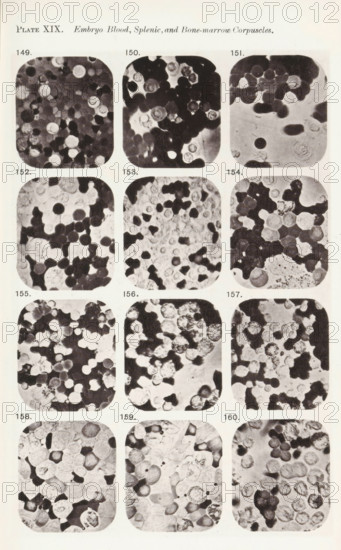 Twelve enlargements of blood cells from an embryo, page, photomechanical print, number: 'Photo. 149., Photo. 160.', number: 'Pl. XIX.', photographer: Richard Norris, clichémaker: anonymous, c. 1872 - in or before 1882, paper, collotype, light print, height 213 mm x width 135 mm, Page opposite page 224., blood, A vertical page with a printed title at the top and a grid of rounded-rectangle black-and-white microscopic images arranged in columns and rows, each image showing densely packed circular and irregular cell-like shapes with varying shades of gray and dark centers; small numeric labels appear above or beside each rounded image; the top left corner has a plate notation and a short italicized header; the overall page shows a pale background with slight texture and margins around the grid.
