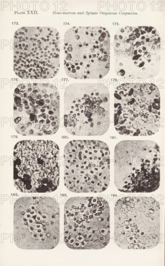 Twelve enlargements of bone marrow, page, photomechanical print, number: 'Pl. XXII.', number: 'Photo. 173., Photo. 184.', photographer: Richard Norris, cliché maker: anonymous, c. 1872 - in or before 1882, paper, collotype, photoprint, height 213 mm x width 135 mm, Page opposite page 229., blood, A vertical sheet showing a grid of rounded square photographic panels arranged in three columns and five rows, each panel containing close-up grayscale images of irregular circular and oval shapes with varying textures and densities, some panels showing dense clusters of dark round forms against lighter backgrounds while others show more scattered, faintly shaded circles and amorphous darker blotches, with visible grain and spotty staining across many panels and margins of the sheet showing light paper texture.