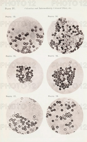 Six enlargements of blood cells, page, photomechanical print, number: 'Photo. 13., Photo. 18.', number: 'Pl. IV.', photographer: Richard Norris, cliché maker: anonymous, c. 1872 - in or before 1882, paper, collotype, photoprint, height 213 mm x width 135 mm, Page opposite page 203., blood, The image shows a pale rectangular page with six circular close-up images arranged in three rows and two columns, each circle containing numerous small round disc-like shapes varying in darkness and translucency against light backgrounds; the top row circles feature scattered clusters of discs with some darker filled circles and some lighter rings, the middle row circles display denser, more compact groupings forming roughly heart-like or cluster shapes with varied shading, and the bottom row circles show more dispersed arrangements with individual discs and small chains, all circles appearing within a clean margin on the page.