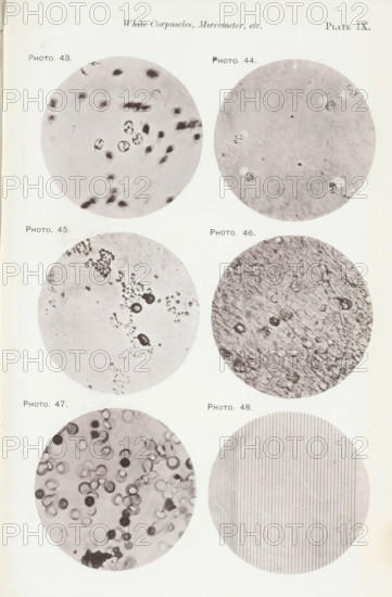 Five enlargements of blood and a micrometer, page, photomechanical print, number: 'Pl. IX.', number: 'Photo. 43., Photo. 48.', photographer: Richard Norris, clichémaker: anonymous, c. 1872 - in or before 1882, paper, collotype, light print, height 213 mm x width 135 mm, Page opposite page 208., blood, A vertical page showing a grid of round photographic circles arranged in two columns and multiple rows, each circle containing different close-up grayscale microscopic or textured images; the top row has two circles with faint cellular shapes and irregular dark spots, the second row shows a circle with scattered small clustered particles opposite a circle with a mottled fibrous texture and a few round darker formations, the third row presents a circle filled with many round ring-like shapes and varied shading opposite a circle composed of fine evenly spaced vertical lines, all circles set against a light background.