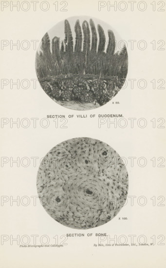 Section of villi of duodenum, Section of bone, page, photomechanical print, inscription: 'x 50. x 100.', printmaker: Bale, Sons & Danielson Ltd., London, c. 1889 - in or before 1899, photographer, paper, collotype, photoprint, height 225 mm x width 155 mm, Prints opposite page 160., bones in general (human body), intestines, A vertical cream-colored page shows two circular grayscale microscope images aligned one above the other, each surrounded by blank margin; the top circle contains a textured pattern with elongated fingerlike projections extending upward from a dense basal layer and a mottled lower region, while the bottom circle displays a concentric, ringed pattern with small dark spots scattered throughout and subtle radial striations.