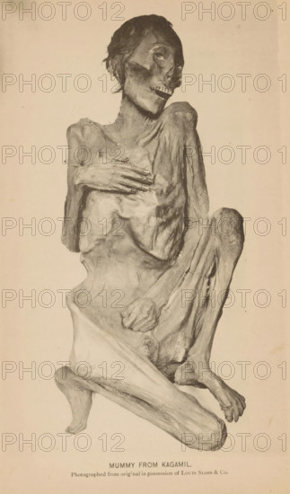 Mummy from Kagamil Island in Alaska, Mummy from Kagamil, page, photomechanical print, inscription: 'Photographed from original in possession of Louis Sloss & Co.', photographer: anonymous, cliché maker: Photo-Engraving Co., New York (city), c. 1885 - in or before 1890, North America, paper, collotype, photoprint, height 187 mm x width 114 mm, mummy, A sepia-toned photograph of a human mummy displayed upright with a tilted head and exposed teeth, sunken eye sockets, and remnants of dark hair; the torso is emaciated with ribs and collarbones prominent, one hand rests across the chest while the other is curled near the abdomen, the skin appears tightly desiccated and wrinkled with visible fibrous texture; the legs are drawn up with knees bent and feet visible, the background is plain and light-colored.