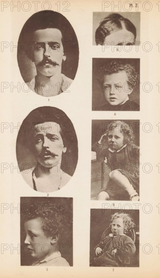 Overview of seven photographs illustrating people with different facial expressions, page, photomechanical print, inscription: 'Pl.2', c. 1868 - in or before 1873, paper, collotype, photogravure, height 229 mm x width 113 mm, historical persons, morphology of facial expression, A vertical page shows a series of sepia-toned photographic portraits arranged in two columns, the left column featuring oval-framed head-and-shoulders images of an adult man with a mustache in two different expressions and a profile view of a young boy, while the right column contains rectangular portraits of children including a cropped forehead view, a curly-haired child looking forward, a child seated with one arm resting on a surface and a leg bent, and a child sitting in a chair with hands resting on the lap; the background is light and the images have a vintage, grainy texture.