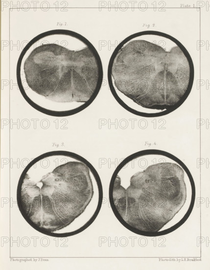 Four details of a medulla oblongata of a sheep, page, photomechanical print, number: 'Plate I. Fig. 1. Fig 2. Fig. 3. Fig. 4.', photographer: John Dean, printmaker: Bradford & Co, LH, c. 1854 - in or before 1864, paper, photolithography, height 301 mm x width 230 mm, brains, A vertical page with four circular black-bordered images arranged in a two-by-two grid, each circle containing a grayscale, textured, roughly heart-shaped form with radiating fine lines and mottled shading, darker outer rims, and lighter central areas; the top pair sits higher on the page with small spaces between them and the bottom pair, while the overall page has a thin rectangular border and pale background.