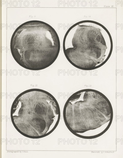 Four details of a sheep medulla oblongata, page, photomechanical print, number: 'Plate III. Fig. 9. Fig 10. Fig. 11. Fig. 12.', photographer: John Dean, printmaker: Bradford & Co, LH, c. 1854 - in or before 1864, paper, photolithography, height 301 mm x width 230 mm, brains, A vertical sheet with a thin rectangular border contains four circular grayscale images arranged in two rows, each circle bordered by a dark ring; the images show textured, irregular organic patterns with light and dark mottling and smooth transitions, including lighter crescent-shaped areas near the edges and varied grainy shading across each circle, with subtle curved striations and patches of smoother highlights; the top two circles sit near the upper half of the sheet and the bottom two near the middle, leaving margins of blank pale paper around them.