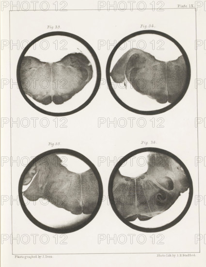 Four details of a human medulla oblongata, page, photomechanical print, number: 'Plate IX. Fig. 33. Fig 34. Fig. 35. Fig. 36.', photographer: John Dean, printmaker: Bradford & Co, LH, c. 1854 - in or before 1864, paper, photolithography, height 301 mm x width 230 mm, brains, A vertical sheet shows four circular monochrome images arranged in a grid, each containing a rounded organic shape with textured surfaces and subtle shading variations; the top two circles display similar wide, lobed forms with fine radiating striations and darker outer rims, while the bottom two circles show comparable shapes with irregular edges, lighter central areas, and darker perimeters, all set against a pale background with a thin rectangular border around the page.