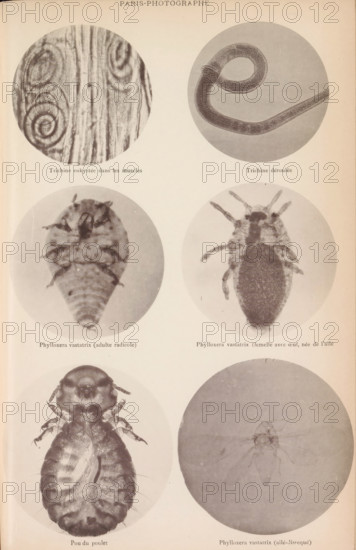 Overview of six microscopic enlargements, page, photomechanical print, Top two hairworms, middle two aphids, bottom two aphids., inscription: 'Trichine enkystée, Phylloxera vastatrix (aillé-dissequé)', France, c. 1881 - in or before 1891, paper, collotype, photogravure, height 260 mm x width 170 mm, Page by page 393., microscope, worms, insects: louse, A vertical page shows a grid of circular photographic plates arranged in two columns and three rows, each plate containing a close-up monochrome image of small organisms or textured structures; the top left plate displays a spiral pattern embedded in fibrous vertical striations, the top right plate shows a long curved tubular form coiled into a loop, the middle left plate contains an oval segmented body with a tapered end and small protruding appendages, the middle right plate features an elongated oval creature with multiple short legs radiating from its sides and a darker central area, the bottom left plate presents a larger, more deta...