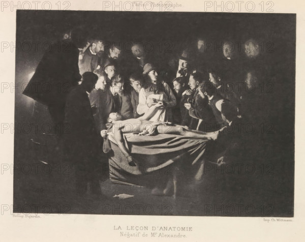 Anatomic lesson, Le leçon d'anatomie, page, photomechanical print, photographer: Alexandre, France, cliché maker: Dujardin, printer (person): Charles Wittmann, c. 1884 - in or before 1894, Alexandre, Dujardin, Charles Wittmann, photographer, cliché maker, printer (person), paper, photoaquatint, height 121 mm x width 167 mm, anatomical specimen, A dimly lit scene shows a group of men gathered closely around a central table where a nude male figure lies on his back with one arm hanging off the table and a cloth draped low over his hips, the men leaning in with focused expressions and varied headwear and clothing, some holding small objects and one appearing to gesture toward the body, the surrounding space receding into deep shadow with faces and hands illuminated by a single light source above the table.