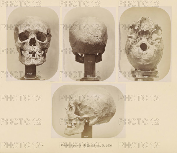 Four images of a Sami female skull, Cranio lappone ?, di Kautokeino, No. 2606, page, Top left a front view, top center a rear view, top right a view of the underside, bottom a side view., number: '2606', number: 'Tavola XL.', photographer: Paolo Mantegazza, Scandinavia, photographer: Carlo Pietro Stefano Sommier, c. 1870 - in or before 1880, paper, albumen print, height 254 mm x width 340 mm, Photos in photo section at the back., (human) skull, Three photographic panels arranged in a row show a human skull from three different angles, each mounted on a vertical support; the left panel displays a frontal view with empty eye sockets, a nasal cavity, and an upper and lower jaw with several teeth present and some missing, the central panel shows the back of the skull with visible cranial sutures and a rounded occipital area, and the right panel presents a view from below revealing the underside of the skull with the upper dental arch and a large circular aperture; beneath these panels a la...