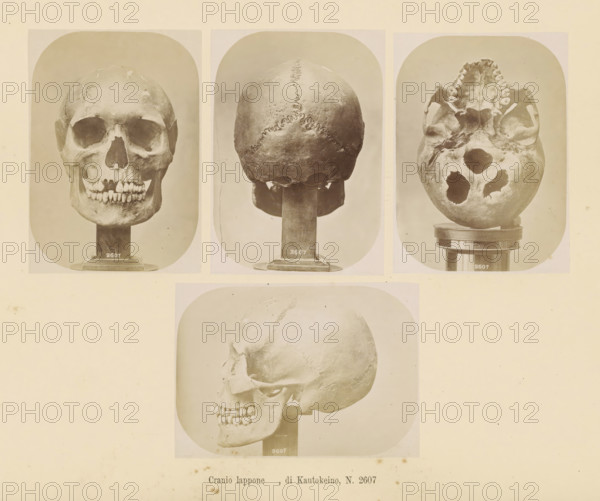 Four images of a Sami skull, Cranio lappone, di Kautokeino, No. 2607, page, Top left a front view, top center a rear view, top right a view of the underside, bottom a side view., number: '2607', number: 'Tavola XLI.', photographer: Paolo Mantegazza, Scandinavia, photographer: Carlo Pietro Stefano Sommier, c. 1870 - in or before 1880, paper, albumen print, height 254 mm x width 340 mm, Photos in photo section at the back., (human) skull, Three photographic prints of a human skull mounted on stands are arranged across the top of the page and one larger photographic print of the same skull in profile is centered below them, all images shown on a pale background. The left top photograph shows a frontal view of the skull with visible eye sockets, nasal opening, and a row of teeth resting on a rectangular stand. The center top photograph shows the rear of the skull with a visible jagged suture line running vertically and horizontally and the skull mounted on a similar stand. The right top ph...