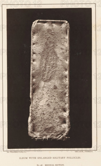 Ileum with Enlarged Solitary Follicles, page, photomechanical print, address: '1002 Arch St., Philadelphia.', number: 'No. 98. MEDICAL SECTION.', photographer: Edward J. Ward, cliché maker: American Photo-Relief Printing Company, Philadelphia, c. 1874 - in or before 1879, North America, paper, Woodburytype, Woodburytypepie, height 200 mm x width 121 mm, anatomical specimen, intestines, A tall, narrow rectangular object with rounded corners fills the central vertical space, its surface showing a textured, irregular pattern with small raised bumps and creases; the rectangle appears to be stitched along both long edges and the bottom, with visible thread loops at the lower edge, and it is set against a dark rectangular background framed by a lighter border.