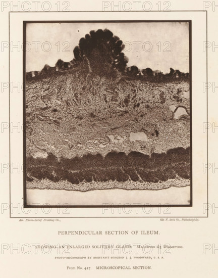 Perpendicular Section of Ileum Showing an Enlarged Solitary GlandS, Enlargement of a swollen gland in a piece of ileum, page, photomechanical print, address: '624 N. 24th St., Philadelphia.', inscription: 'Magnified 63 diameters., Photo-micrograph by assistant surgeon JJ Woodward, USA, From No. 417. MICROSCOPICAL SECTION.', photographer: Joseph Janvier Woodward, cliché maker: American Photo-Relief Printing Company, Philadelphia, c. 1874 - in or before 1879, North America, paper, Woodburytype, Woodburytypepie, height 127 mm x width 115 mm, anatomical specimen, intestines, A rectangular sepia-toned image bordered by a darker inner frame sits on a pale background; inside the rectangle a textured microscopic cross-section shows layered, grainy patterns with a darker scalloped band near the bottom, a mottled central area of various densities and swirling textures, and an irregular darker protrusion rising toward the top center surrounded by lighter, speckled regions.
