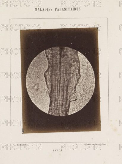 Favus, Microscope image of the disease favus, photograph, page, number: '12', inscription: 'Maladies parasitaires', inscription: 'Ad naturam phot. et pinx.', photographer: A. de Montméja, c. 1860 - c. 1868, paper, albumen print, height 120 mm x width 90 mm, microscope, skin and venereal diseases, A faded rectangular photograph mounted on an aged cream page shows a circular close-up image with a textured central vertical strip flanked by lighter, mottled areas, all set against a dark background inside the rectangle; thin ruled borders frame the page and there are small spots and stains on the paper.
