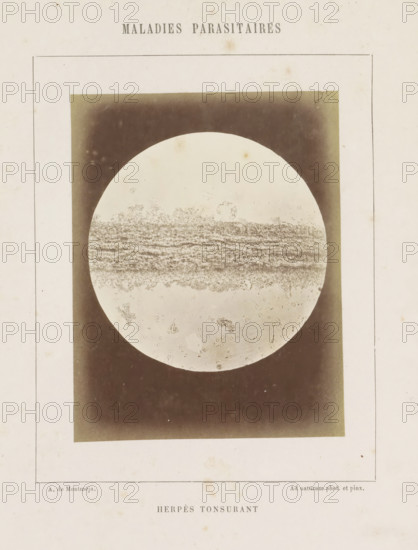 Microscopic image of ringworm on the head, Herpès tonsurant, photograph, page, number: '17', inscription: 'Ad naturam phot. et pinx.', inscription: 'Maladies parasitaires', photographer: A. de Montméja, c. 1860 - c. 1868, paper, albumen print, height 116 mm x width 91 mm, skin and venereal diseases, A faded printed page with a large rectangular dark vignette centered on it containing a circular pale area resembling a microscope view, the circular area showing horizontal textured bands and scattered granular spots, the surrounding rectangle showing uneven dark shading that lightens toward the edges, the page margin showing a thin rectangular border around the central image and faint speckles and stains on the paper.