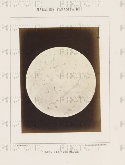 Oidium albicans (Muguet), Microscope image of probably candida albicans, photograph, page, inscription: 'Maladies parasitaires.', number: '20', inscription: 'Ad naturam photo. et pinx.', photographer: A. de Montméja, c. 1860 - c. 1868, paper, albumen print, height 120 mm x width 91 mm, microscope, skin and venereal diseases, A faded rectangular page with a thin border contains a centered dark rectangular photograph showing a large pale circular disc with faint curved and irregular markings against the dark background, small spots and smudges on the disc surface, and lighter areas near the edges of the dark rectangle; the surrounding page shows slight discoloration and small stains.