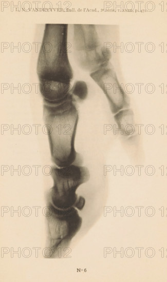 X-ray of a pig's leg, page, photomechanical print, number: 'No 6', photographer: Guequier, Ghent, maker: E. Castelein, Brussels, c. 1891 - in or before 1896, Guequier, E. Castelein, photographer, paper, collotype, photoprint, height 163 mm x width 80 mm, Print on fifth unnumbered page after page 470., X-ray examination, A vertical grayscale image of a close-up radiographic view of toe bones on a light background, showing multiple phalanges and joint spaces with varying shades of gray and darker rounded bone ends; the bones appear aligned in two adjacent columns with one toe slightly angled, and soft-tissue shadows surrounding the bones.