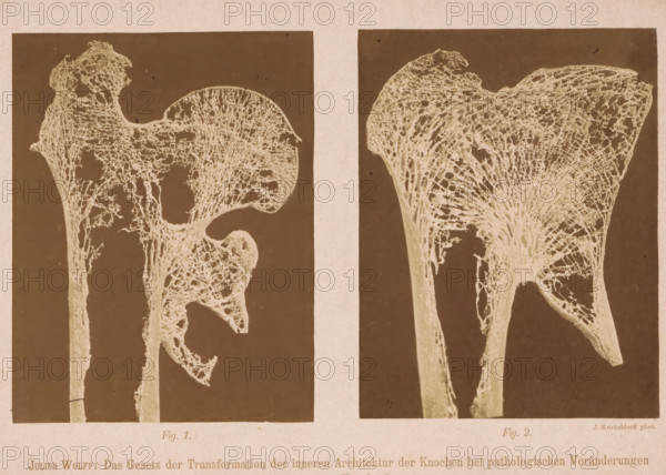 Twice a detail of the structure of the interior of a bone, Julius Wolff: The Gesetz der Transformation der inneren Architektur der Knochen bei pathologischen Veränderungen der äusseren Knochenform, photograph, page, number: 'Taf. I. Fig. 1. Fig. 2.', photographer: Julius Kricheldorff, c. 1874 - c. 1884, paper, albumen print, height 187 mm x width 268 mm, Photos at the back of the book., bones in general (human body), A sepia-toned image divided into two vertical panels shows detailed pale lattice-like structures against darker rectangular backgrounds, each resembling porous, branching organic forms with thin elongated stems leading to broader, irregularly shaped tops; the left panel displays a structure with a rounded upper section and a hooked protrusion, while the right panel shows a larger fan-shaped top with radiating filamentous networks, both set within a lighter border and framed by a narrow vertical strip separating the panels.