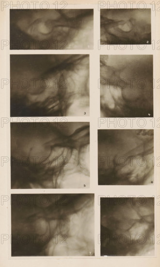 Eight x-rays, photograph, page, name: 'Dr. Alban Köhler', c. 1904 - in or before 1909, photographer, paper, gelatin silver print, developing gelatin silver print, height 188 mm x width 111 mm, Photo in section at the back of the book., X-ray examination, A tall, narrow sheet divided into a grid of rectangular panels filled with soft-focus, monochrome cloudlike textures and swirling shadow patterns, each panel showing blurred organic shapes with gradients from dark to light and wispy, veinlike strands running through them; the sheet has pale borders between panels and a slightly aged, off-white outer margin with small scratches and faint discoloration.
