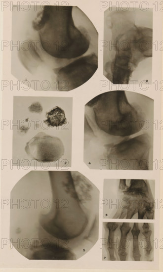 Seven x-rays of various joints and substances, photograph, page, name: 'Dr. Lejeune.', c. 1904 - in or before 1909, photographer, paper, gelatin silver print, developing gelatin silver print, height 182 mm x width 104 mm, Photo in section at the back of the book., X-ray examination, (human) skeleton, A pale background holds a vertical arrangement of photographic panels showing monochrome medical images and tissue samples; the top left panel displays a rounded dark form with softer gray surrounding shapes, while the top right panel shows a vertical elongated structure with layered gray textures. The upper middle left panel contains several irregularly shaped small dark masses and a larger mottled specimen against a light field, and the upper middle right panel features a rounded dark mass adjacent to a lighter curved area. The lower left large panel shows a smooth rounded silhouette with soft shading and a lighter surrounding border, and the lower right column contains a square panel wi...