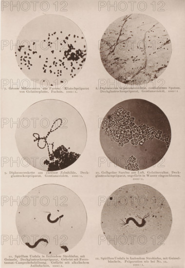 Six microscope images of bacteria and eubacteria, page, photomechanical print, number: 'Tafel II.', inscription: '7. Gross Micrococci from Faeces. Klatschpräparat von Gelatineplatte. Fuchsin. 1000:1. 8. Diplococci in pneumonischem, rostfarbenen Sputum. Deckglassrockenpräparat. Gentianaviolett. 1000:1. 9. Diplococcenkette aus cariöser Zahnhöhle. Deckglassrockenpräparat. Gentianaviolett. 1000:1. 10. Gelbgrüne Sarcine from Luft. Gelatin culture. Deckglasrockenpräparat, ungeefärbt in Wasser eingeschlossen. 1000:1. 11. Spirillum Undula in faulendem Strohinfus, mit Geisseln. Deckglassrockenpräparat. Gebeizt mit Ferrotannat-Campecheholzlösung. Gefärbt mit alkalischem Anilinfuchsin. 1000:1. 12. Spirillum Undula in faulendem Strohinfus, mit Gessel-büscheln. Preparation who bei No. 11. 100:1.', photographer: Carl Günther, Berlin, maker: Friedrich Julius Klinkhardt, Leipzig, c. 1880 - in or before 1890, Saxony, paper, collotype, photoprint, height 242 mm x width 165 mm, Prints in section at the b...