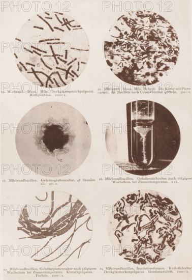 Six microscope images of the anthrax bacterium, page, photomechanical print, number: 'Tafel IV.', inscription: '19. Milzbrand. Maus. Milz. Deckglasausstrichpräparat. Methylenblau. 1000:1. 20. Milzbrand. Maus. Milz. Die Kerne mit Pocrocarmin, die Bacillien nach Gram-Günther gefärbt. 500:1. 21. Milzbrand bacilli. Gelatinplattencultur, 48 Stunden alt. 40:1. 22. Milzbrand bacilli. Gelatin stick culture after 7 days of waiting time at Zimmertemepratur. 1:1. 23. Milzbrand bacilli. Gelatin plate culture after 1 day of waiting time at Zimmertemperatur. Klatschpräparat. Fuchsin. 1000:1. 24. Milzbrand bacilli, Involutionsformen. Kartoffelculture. Deckglassrockenpräparat. Gentianaviolett. 1000:1.', photographer: Carl Günther, Berlin, maker: Friedrich Julius Klinkhardt, Leipzig, c. 1880 - in or before 1890, Saxony, paper, collotype, photoprint, height 242 mm x width 165 mm, Prints in section at the back., unicellular animals, bacteria, bacilli, A vertically oriented aged paper sheet shows a grid o...