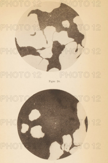 Two microscope images of spoilage bacteria, page, photomechanical print, number: 'Table XII. Figur 19. Figur 20.', photographer: Gustav Hauser, maker: Johann Baptist Obernetter, Munich, publisher: Friedrich Christian Wilhelm Vogel, Leipzig, c. 1875 - in or before 1885, Bavaria, Saxony, paper, collotype, photoprint, height 258 mm x width 170 mm, Prints in section at the back., unicellular animals, bacteria, bacilli, A vertical image of a page showing two large circular dark-and-light patterned disks aligned one above the other on a pale background, the upper disk containing irregular dark regions with textured fine lines and lighter smooth areas with organic shapes and thin branching extensions, and the lower disk showing similar dark textured regions interspersed with lighter rounded voids and narrow connecting strands, with the paper exhibiting a warm beige tone and subtle age marks.