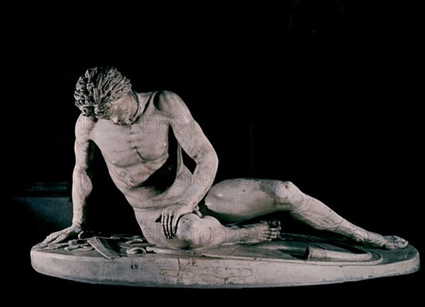 Dying Gaul