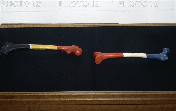 Broodthaers, A Belgian man's femur