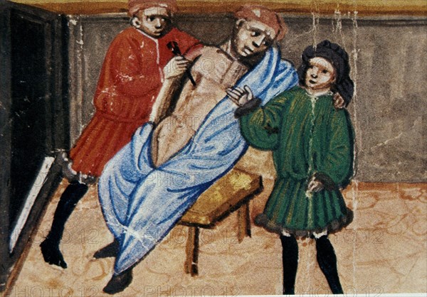 MS 2197 FOL 492-CANON DE AVICENA-OPERACION CON INCISION-ITALIA 1438
BOLONIA, B UNIVERSITARIA
ITALIA