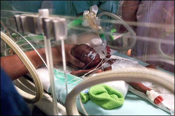 03/02/2002. Premature babies at the intensive care unit of the Cochin hospital.