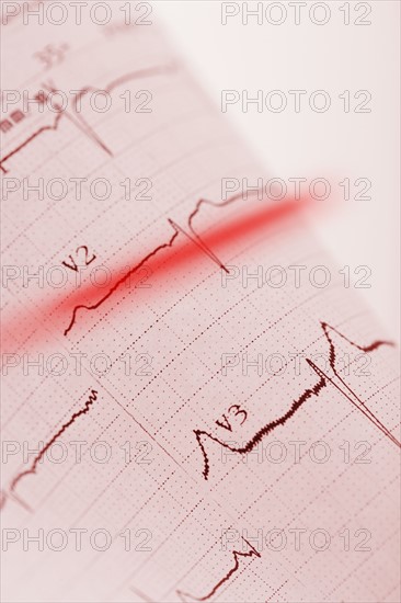 Closeup of heart monitor printout.
