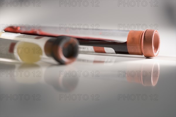 Closeup of blood samples in tubes.