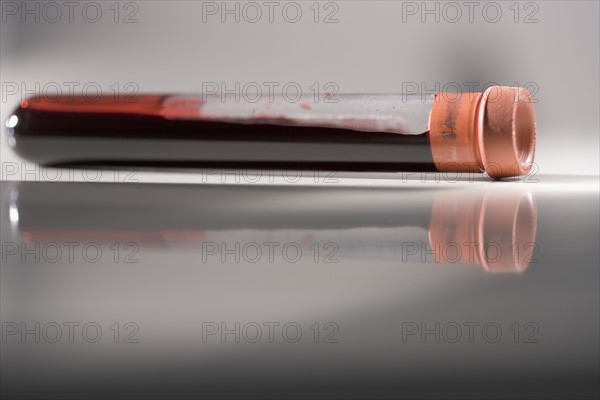 Closeup of blood sample in tube.